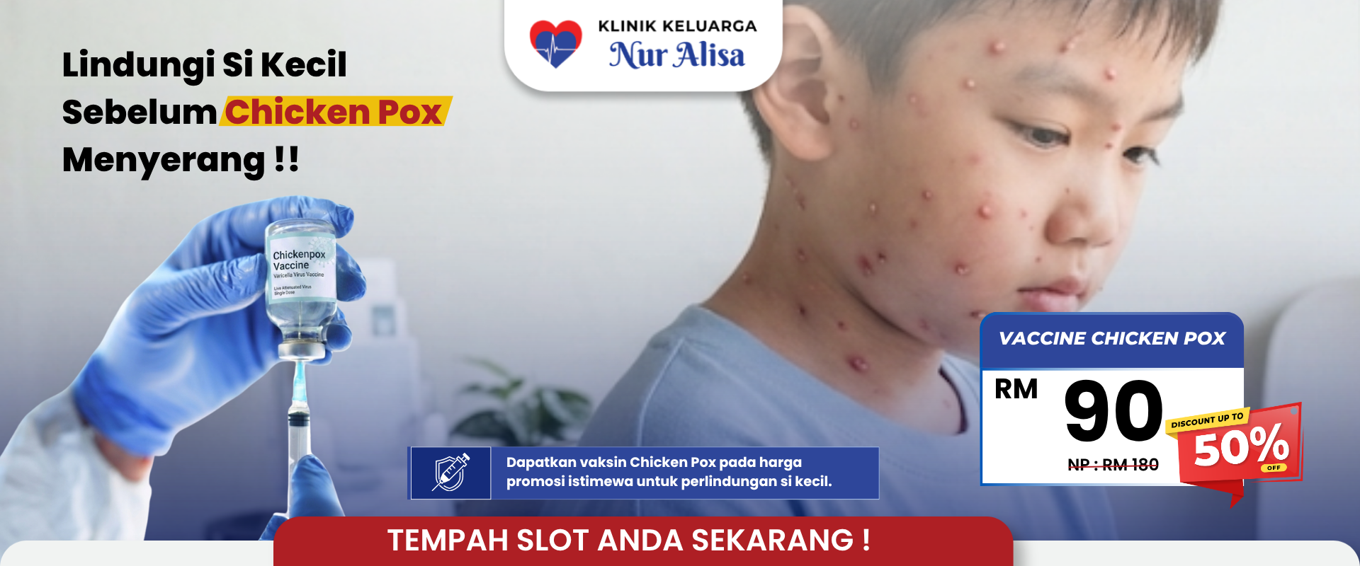nahsb chicken pox